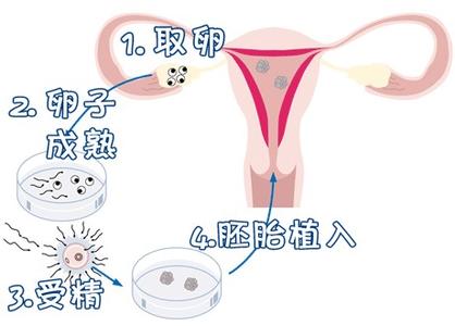 IVF实验室